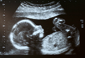 Obstetric Ultrasound in Rye, NY